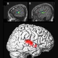 fMRI